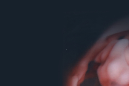 Description of Image 1