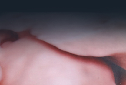 Description of Image 1