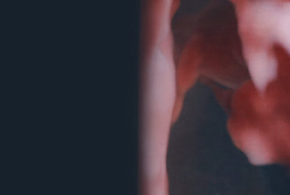 Description of Image 1