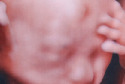 Description of Image 1