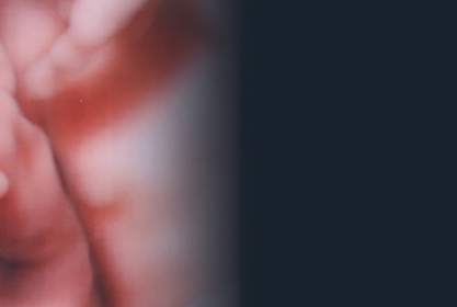 Description of Image 1