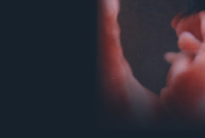 Description of Image 1