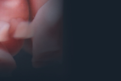 Description of Image 1